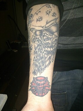 right arm